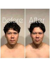 グレースフィオーレ 町田店(gracefiore)/ビフォーアフター/施術1回の効果