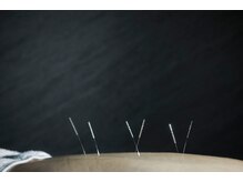 デルタエヌピー63+(δnp63+)/お客様施術例【小顔/薬院/福岡】