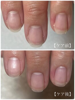 サエコ ネイル (3e5 nail)/◆ ネイルケアコース ◆