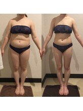 アユアランリンク 札幌中島公園店/B様：6カ月で-14.3Kg！