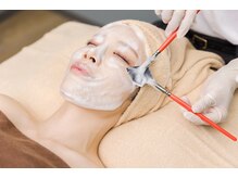 韓国式ララピールはダウンタイムがないから低刺激♪＃再生美容