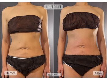 サロンドカメリア(salon de Camellia)/痩身コースは効果絶大!