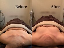 ジェイオー(J.O)/バストアップコルギ/小顔コルギ