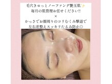 グレイスシャイン(GraceShine)の雰囲気(艶肌へ導くセルマン♪角質整理し栄養を与え年齢.肌に応じたケア)