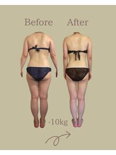 レン サロン(REN.)/【痩身×整体】90分で驚きの結果