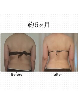 アカアカ('AKA'AKA)/バザルトボディトリートメント