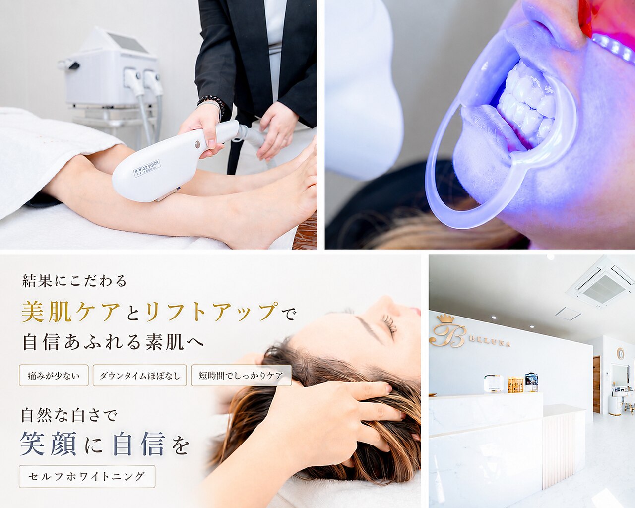 ベルーナ(Belluna)｜ホットペッパービューティー