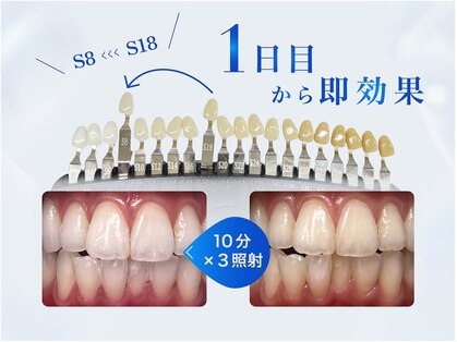 ハイティース 高田馬場店(Hi Teeth!)の写真