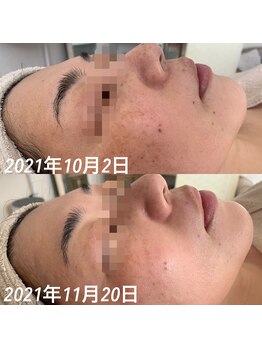 ナヴィータ アオバダイ(Navita AOBADAI)/エンビロン/2ヶ月集中コース