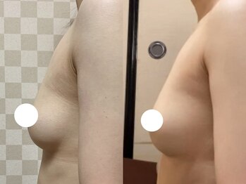 ハレオラ(HaleOla)/お客様の変化☆バストケア