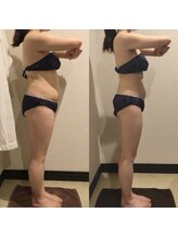 アユアランリンク 札幌中島公園店/B様：側面