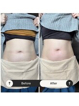 スルリ(sururi)/むくみスッキリ！