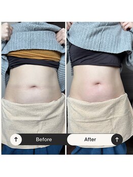 スルリ(sururi)/むくみスッキリ！