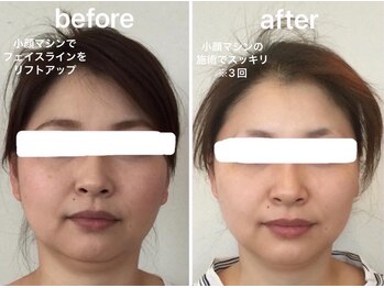 アンベリ(Embelli)