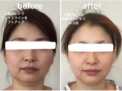 アンベリ(Embelli)の写真