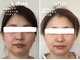 アンベリ(Embelli)の写真