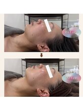 ジェイド(Jade)/初回のbefore→after