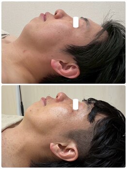 ムー(mu)/10分引き締めコース