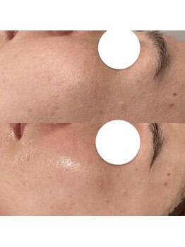 ひっそり美肌構築/乾燥には水玉♪