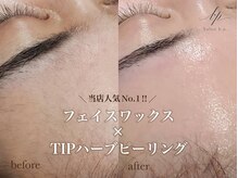 渋谷で唯一無二の技術！ハーブピーリングとツヤ肌WAXの相乗効果で感動体験