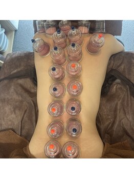 リベル(Liber)/初めてカッピングされる方続出