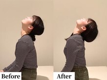 ソレア(Solea)/首こり改善1回目