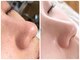 シェミー(CHEZ MEE)の写真/リピーター様多数の大人気メニュー【毛穴徹底ケア】フェイシャル+毛穴洗浄+悩み専用ケアで毛穴レス陶器肌♪