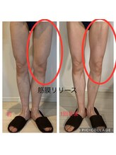 エメ 心斎橋(Aimer)/筋膜リリース痩身エステ