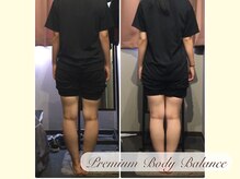 美プレミアム 越谷店/ １３、施術結果(O脚改善)