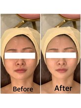 スペチアーレ 夙川/驚きの引き上がり☆