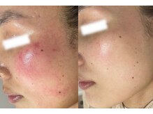 ラポール 野並店(Rapport)/