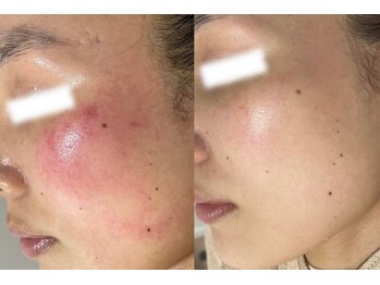 ラポール 野並店(Rapport)/