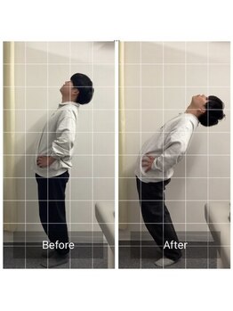 大阪茨木市駅前整体院/腰痛改善♪