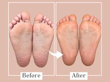 ベベ(Bebe)/20代女性/ニオイお悩み