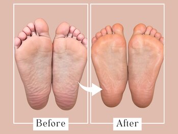 ベベ(Bebe)/20代女性/ニオイお悩み