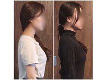 あん楽の雰囲気（姿勢矯正の例）