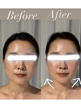 サロンドベベ(salon de Bebe.)/お客様ビフォーアフター