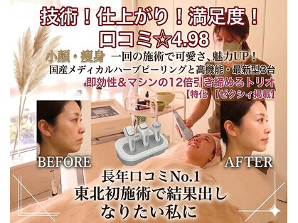 オーブ(Aube)の写真