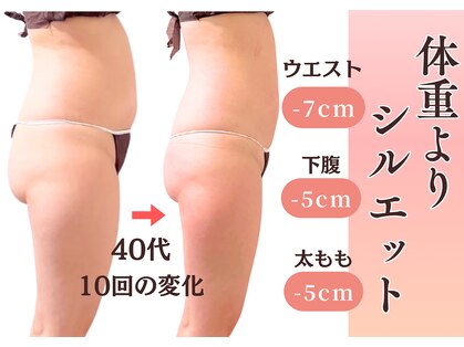 エルナ(Eluna)の写真