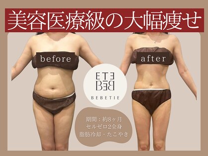 ベベティー(BEBETIE)の写真