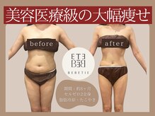 ベベティー(BEBETIE)