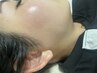 【2回目以降の方】美肌フェイシャルワックス＋HBL＋保湿パック