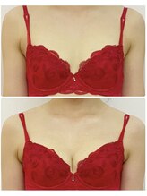 ラビス(RAVIS)/30代☆バストアップ