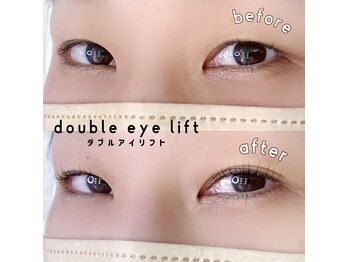 リット(LIT)/ダブルアイリフト