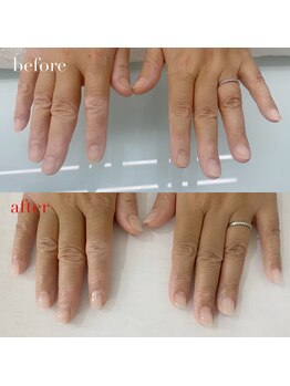 アイネイルズ 布施店(I.NAILS)/深爪/深爪矯正/自爪風ネイル