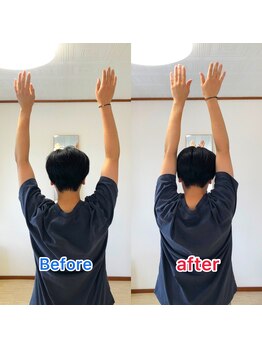 整体サロン佑/整体/beforeAfter