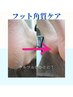 【ガサガサかかとがふっくら♪】スペシャル角質ケアコース★¥8,000→