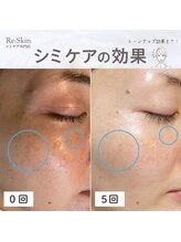 リスキン(Re:Skin)/