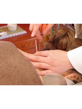 鍼灸施術を受けたい