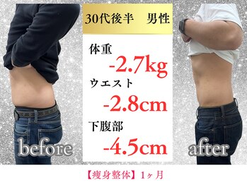ボディメイク アールエフ サクラ接骨院(bodymake RF SAKURA接骨院)/30代　1ヶ月で下腹部ー4.5cm